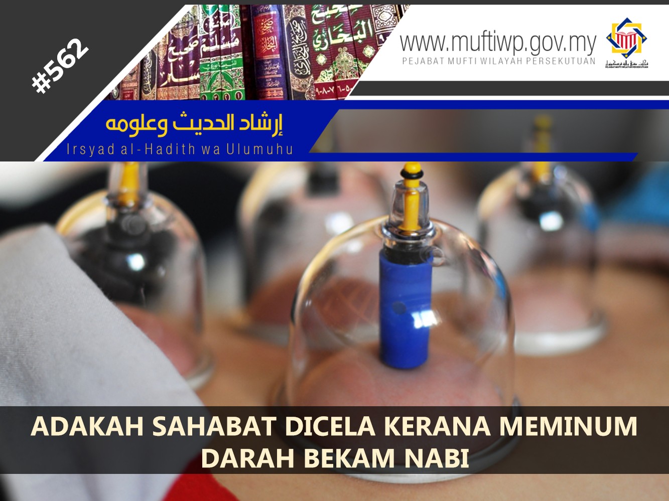 ADAKAH_BENAR_SAHABAT_DICELA_KERANA_MEMINUM_DARAH_BEKAM_NABI.jpg